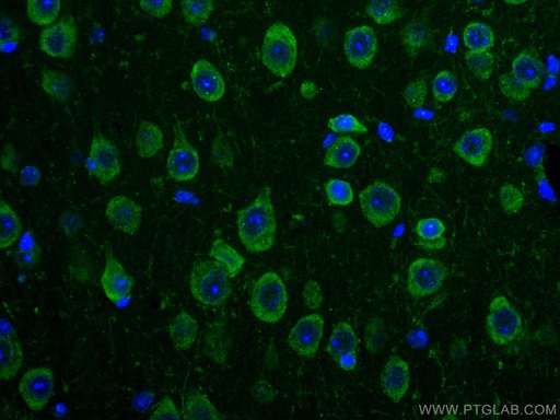 [CL488-67342-100UL] CoraLite®488-conjugated TRIM2 Monoclonal antibody