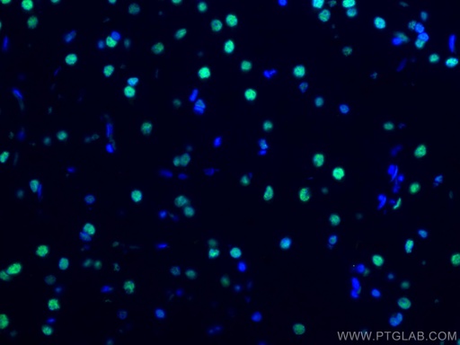 [CL488-67345-100UL] CoraLite®488-conjugated TDP-43 (C-terminal) Monoclonal antibody