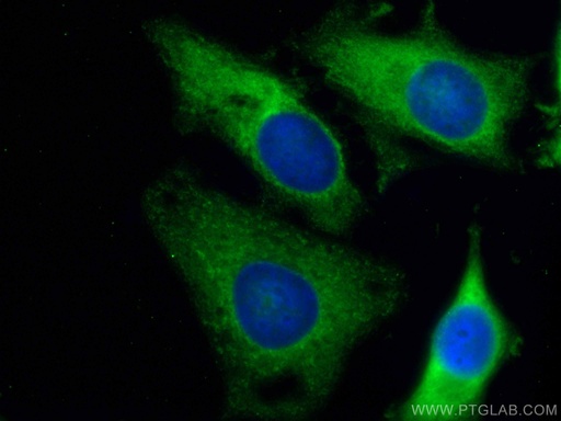 [CL488-67453-100UL] CoraLite®488-conjugated ALDOA Monoclonal antibody