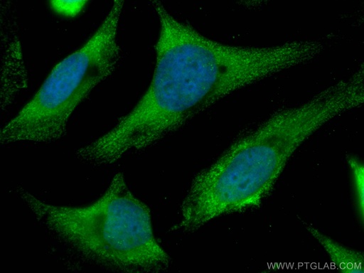 [CL488-67519-100UL] CoraLite®488-conjugated CMPK1 Monoclonal antibody