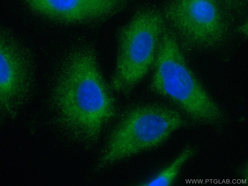 [CL488-67590-100UL] CoraLite®488-conjugated VPS18 Monoclonal antibody