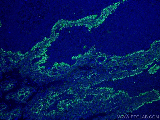[CL488-67605-100UL] CoraLite®488-conjugated CD63 Monoclonal antibody