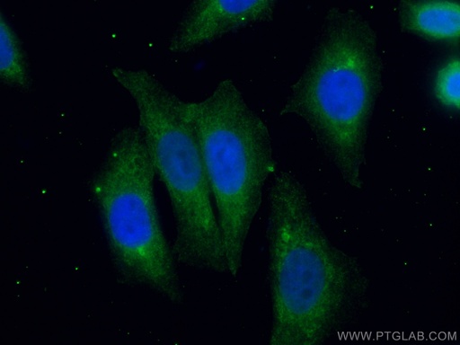 [CL488-67631-100UL] CoraLite®488-conjugated Ch-TOG Monoclonal antibody