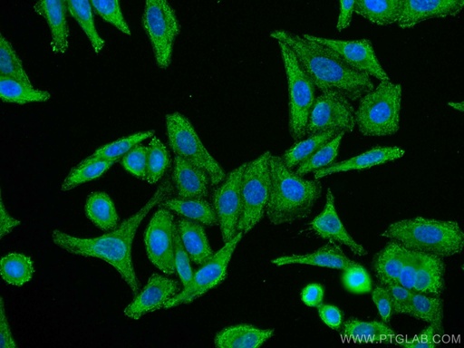 [CL488-67729-100UL] CoraLite®488-conjugated RPL6 Monoclonal antibody