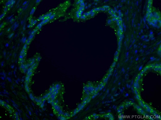 [CL488-67734-100UL] CoraLite®488-conjugated CTPS2 Monoclonal antibody