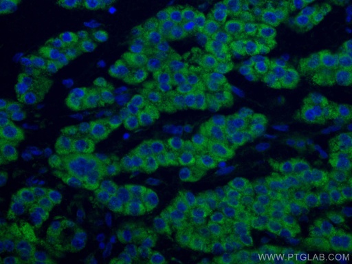 [CL488-67742-100UL] CoraLite®488-conjugated ACADM Monoclonal antibody