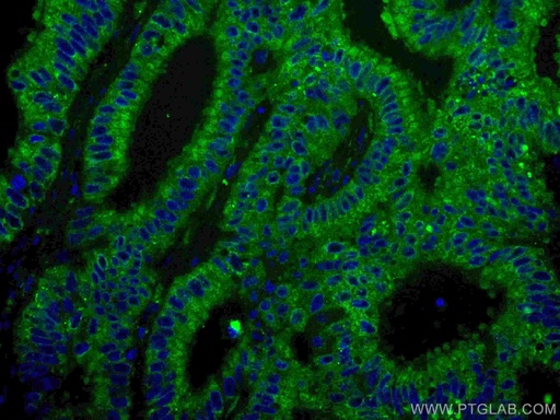 [CL488-67754-100UL] CoraLite®488-conjugated ING4 Monoclonal antibody