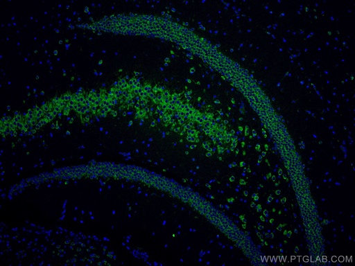[CL488-67813-100UL] CoraLite®488-conjugated FXR1 Monoclonal antibody