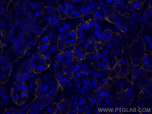 [CL555-11739-100UL] CoraLite®555-conjugated ASGR1 Polyclonal antibody