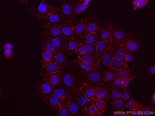 [CL555-51067-100UL] CoraLite®555-conjugated Beta Catenin Polyclonal antibody