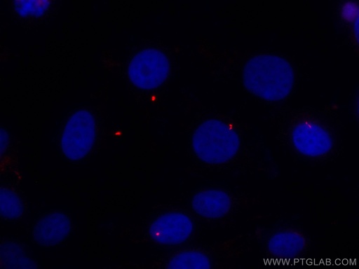 [CL555-66200-100UL] CoraLite®555-conjugated acetylated Tubulin(Lys40) Monoclonal antibody