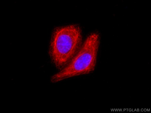 [CL594-10143-100UL] CoraLite®594-conjugated Cytokeratin 14 Polyclonal antibody