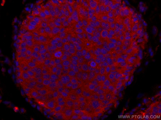 [CL594-10233-100UL] CoraLite®594-conjugated NDE1 Polyclonal antibody