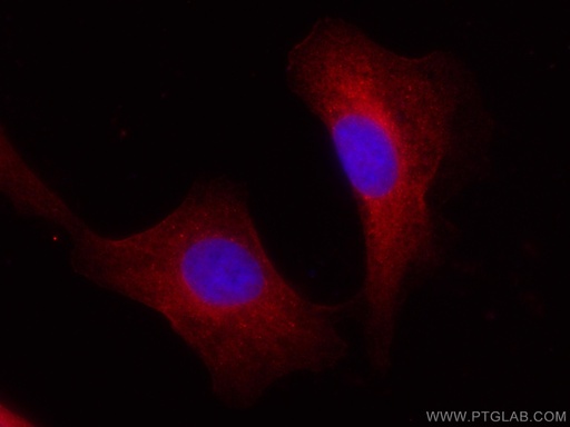 [CL594-10599-100UL] CoraLite®594-conjugated BAG3 Polyclonal antibody