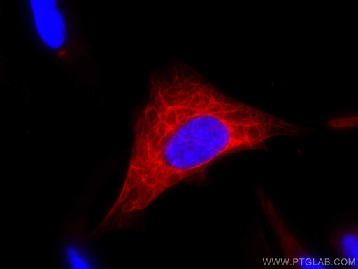 [CL594-10712-100UL] CoraLite®594-conjugated Cytokeratin 19 Polyclonal antibody