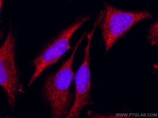 [CL594-10795-100UL] CoraLite®594-conjugated Sestrin 2 Polyclonal antibody
