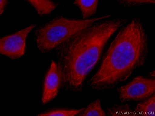 [CL594-10830-100UL] CoraLite®594-conjugated Cytokeratin 18 Polyclonal antibody