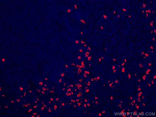 [CL594-11449-100UL] CoraLite®594-conjugated Human IgA Heavy Chain Polyclonal antibody