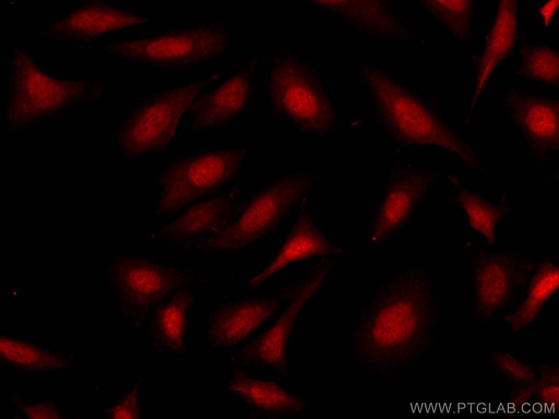 [CL594-11614-100UL] CoraLite®594-conjugated RBM4 Polyclonal antibody