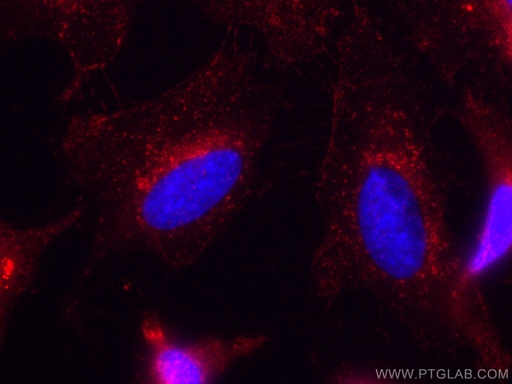 [CL594-11714-100UL] CoraLite®594-conjugated IFITM3 Polyclonal antibody
