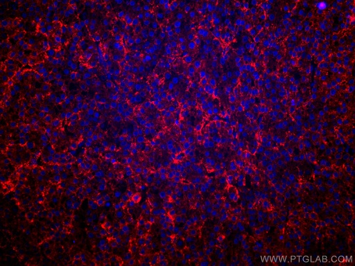 [CL594-11739-100UL] CoraLite®594-conjugated ASGR1 Polyclonal antibody