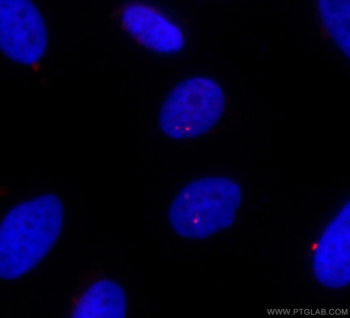 [CL594-11744-100UL] CoraLite®594-conjugated IFT81 Polyclonal antibody