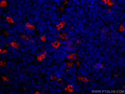 [CL594-12008-100UL] CoraLite®594-conjugated TIMD4 Polyclonal antibody