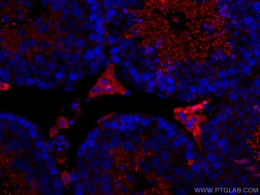 [CL594-12225-100UL] CoraLite®594-conjugated STAR Polyclonal antibody