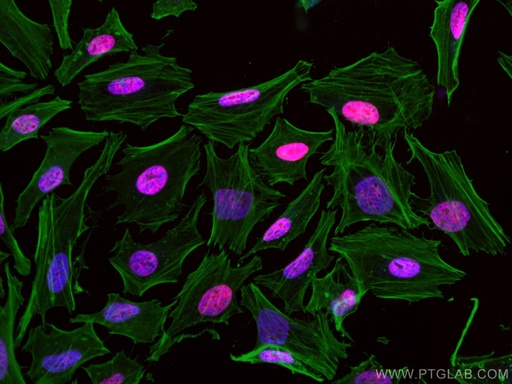 [CL594-12439-100UL] CoraLite®594-conjugated CREST Polyclonal antibody