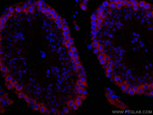 [CL594-12633-100UL] CoraLite®594-conjugated DAZL Polyclonal antibody