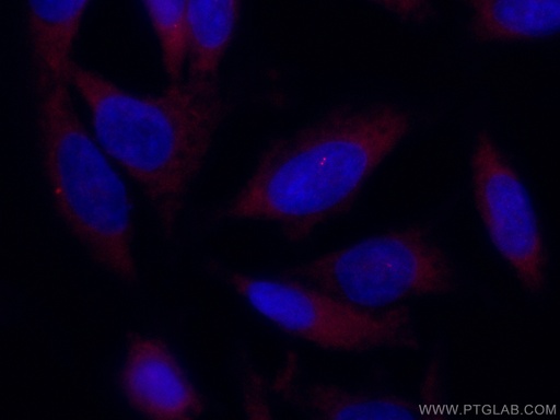 [CL594-12780-100UL] CoraLite®594-conjugated CP110 Polyclonal antibody