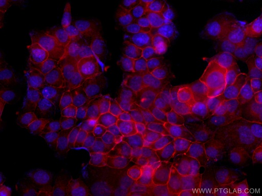 [CL594-13409-100UL] CoraLite®594-conjugated Occludin Polyclonal antibody