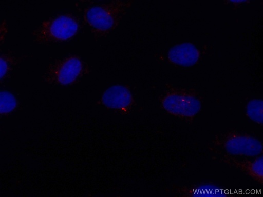 [CL594-13967-100UL] CoraLite®594-conjugated IFT88 Polyclonal antibody