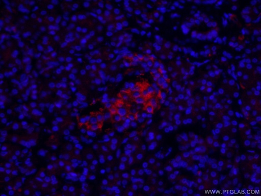 [CL594-14157-100UL] CoraLite®594-conjugated KRAP/SSFA2 Polyclonal antibody
