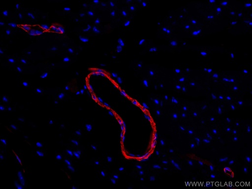 [CL594-14395-100UL] CoraLite®594-conjugated smooth muscle actin Polyclonal antibody