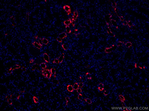 [CL594-14479-100UL] CoraLite®594-conjugated Calbindin-D28k Polyclonal antibody