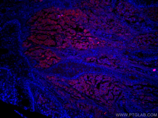 [CL594-15146-100UL] CoraLite®594-conjugated S100 Beta Polyclonal antibody