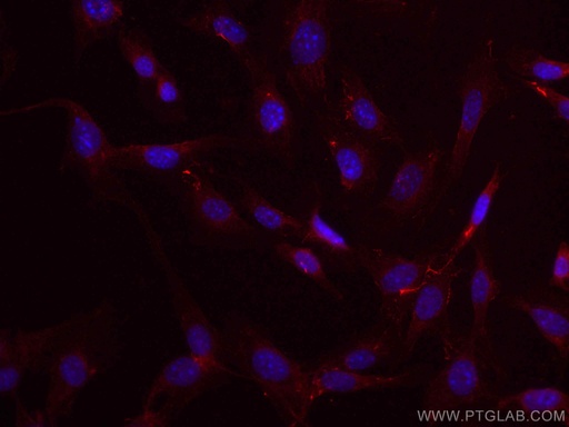 [CL594-15613-100UL] CoraLite®594-conjugated Fibronectin Polyclonal antibody
