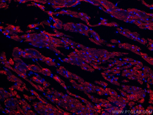 [CL594-16520-100UL] CoraLite®594-conjugated Desmin Polyclonal antibody
