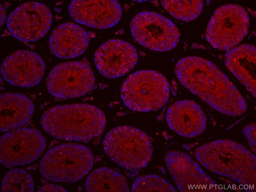 [CL594-17460-100UL] CoraLite®594-conjugated IFT140 Polyclonal antibody