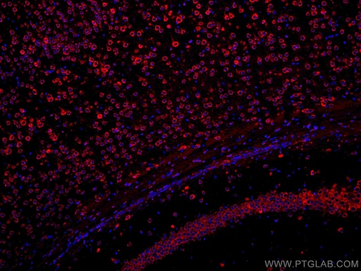 [CL594-17479-100UL] CoraLite®594-conjugated YTHDF1 Polyclonal antibody