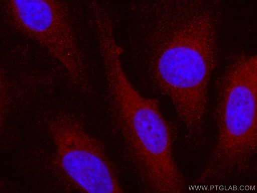 [CL594-19003-100UL] CoraLite®594-conjugated VEGF Polyclonal antibody