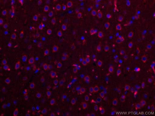 [CL594-19483-100UL] CoraLite®594-conjugated Nestin Polyclonal antibody