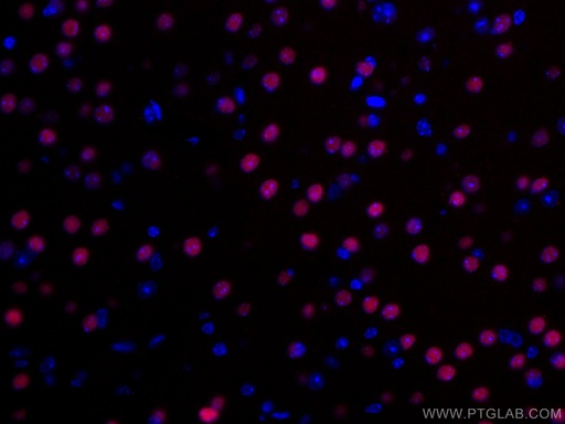 [CL594-20932-100UL] CoraLite®594-conjugated TBR1 Polyclonal antibody