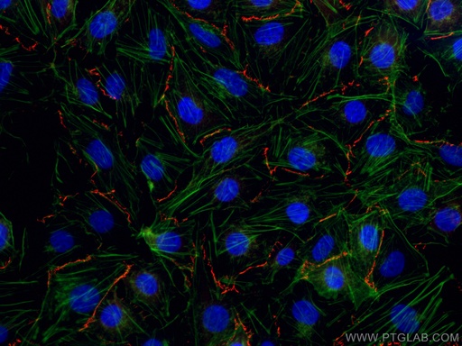 [CL594-21773-100UL] CoraLite®594-conjugated ZO-1 Polyclonal antibody