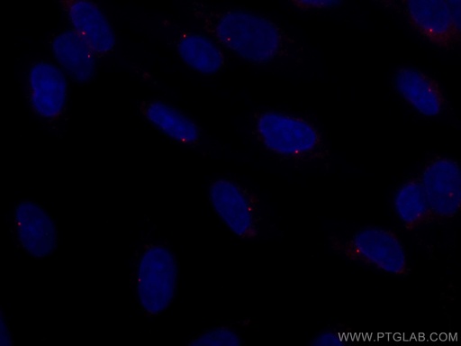 [CL594-22227-100UL] CoraLite®594-conjugated CEP164 Polyclonal antibody