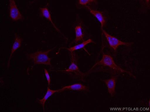 [CL594-23418-100UL] CoraLite®594-conjugated Osteocalcin Polyclonal antibody