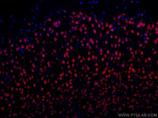 [CL594-26975-100UL] CoraLite®594-conjugated NeuN Polyclonal antibody