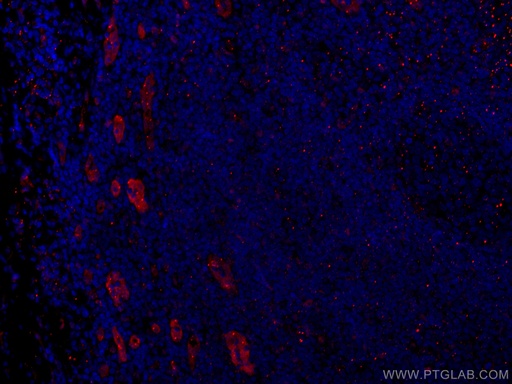 [CL594-60046-100UL] CoraLite®594-conjugated ACKR2 Monoclonal antibody