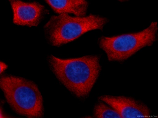 [CL594-60073-100UL] CoraLite®594-conjugated RRM1 Monoclonal antibody